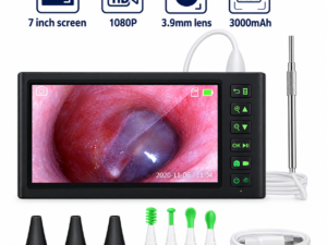 Video Otoscope