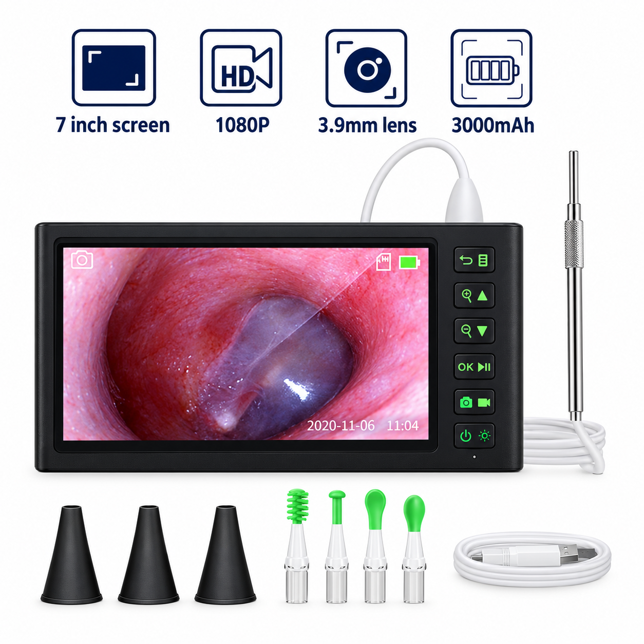 Video Otoscope